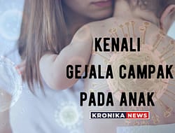 KENALI GEJALA AWAL CAMPAK PADA ANAK YANG DAPAT MENURUNKAN DAYA TAHAN TUBUH