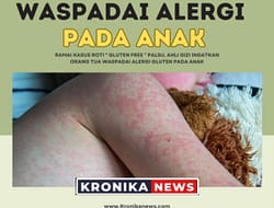 RAMAI KASUS ROTI ” GLUTEN FREE ” PALSU, AHLI GIZI INGATKAN ORANG TUA WASPADAI ALERGI GLUTEN PADA ANAK